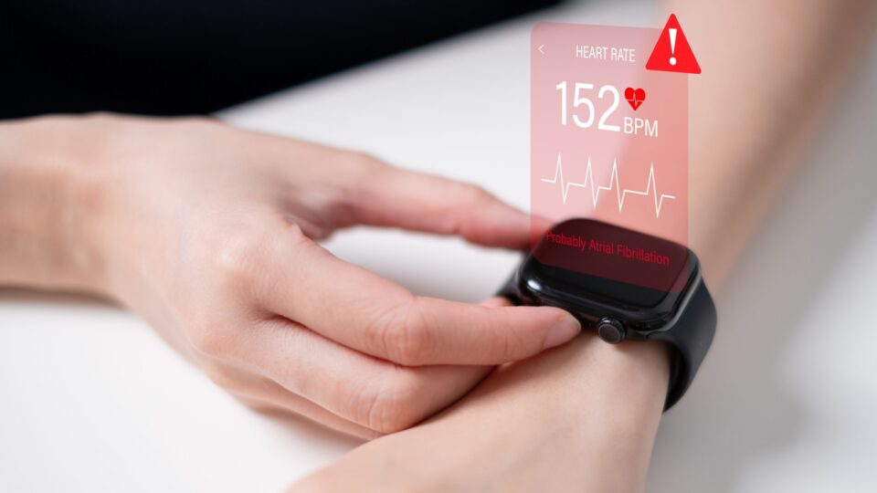 Eine Person überprüft die Herzfrequenz auf einer Smartwatch, die eine erhöhte Herzfrequenz von 152 BPM und einen Warnhinweis auf Vorhofflimmern anzeigt.